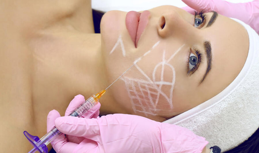 Биоармирование лица (жидкие нити) - Центр врачебной косметологии "Марина" в Чебоксарах