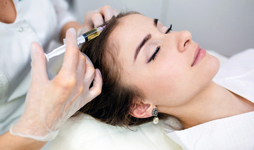 Мезотерапия для волос - Центр врачебной косметологии "Марина" в Чебоксарах